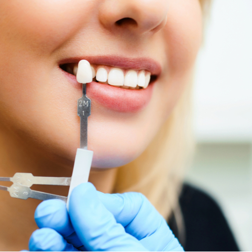 shutterstock_1089163193 (1) dental implant model