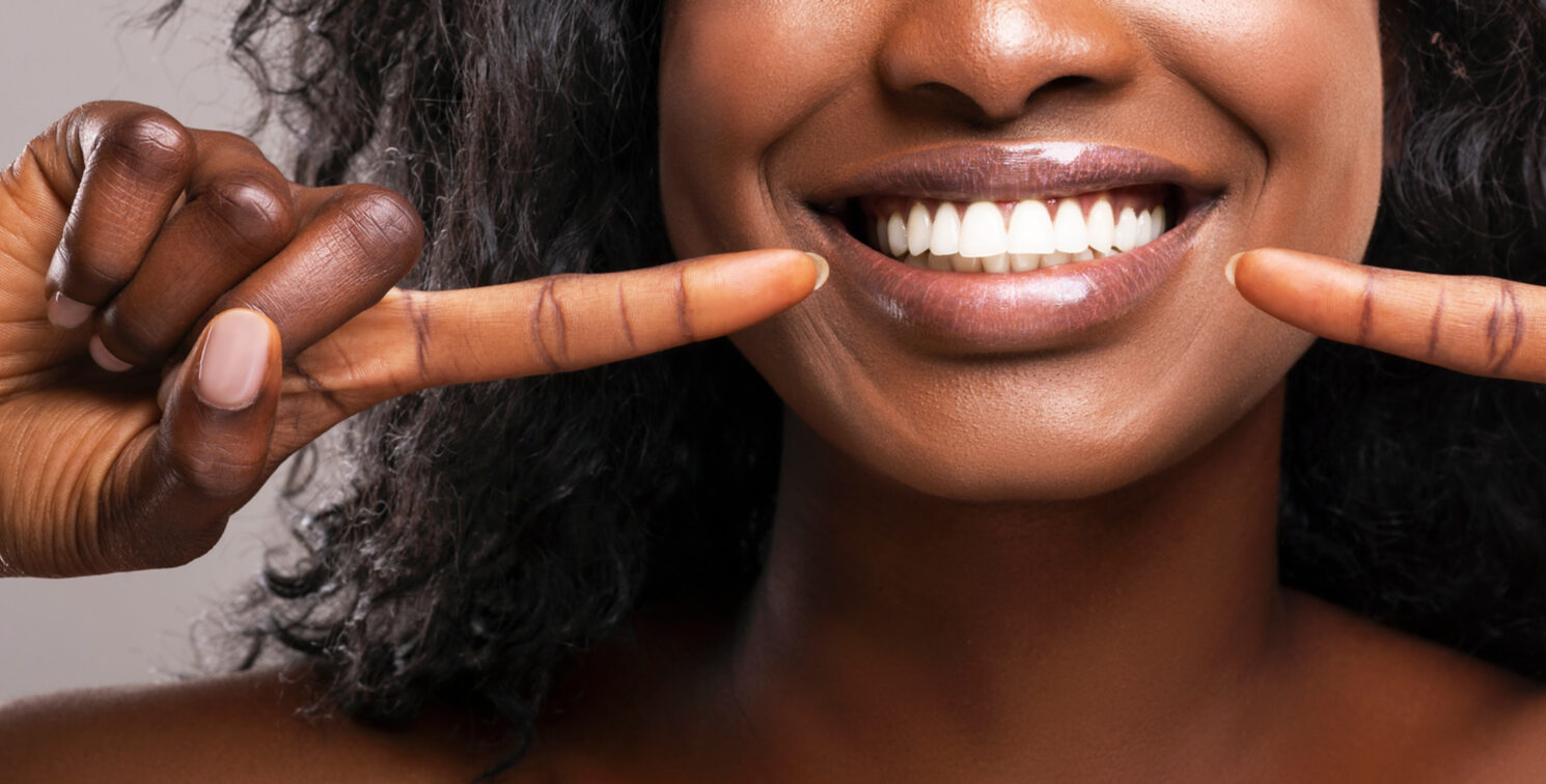 Close up Image of Female Pointing to White Bright Smiling Teeth