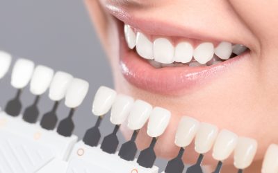 3 Reasons Why You Should Consider Teeth Whitening