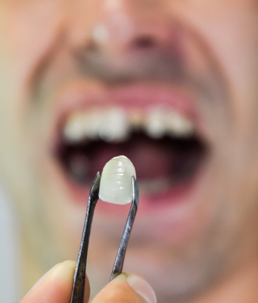 shutterstock_1219100356 woman placing her Invisalign trays on her teeth