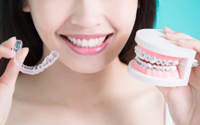 Reasons to Choose Invisalign Treatment