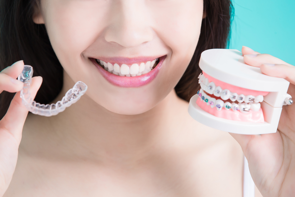 woman holding Invisalign retainer in one hand and a model of traditional metal braces in the other