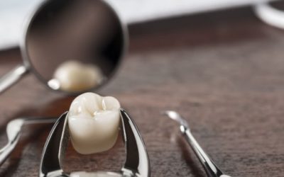 Exploring the Costs of Different Dental Crown Types