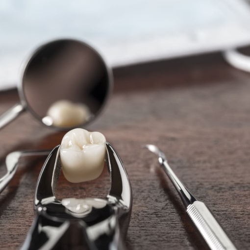 Wisdom Teeth Removal at Sekhon Family Dentistry Close up of Tooth and Tools