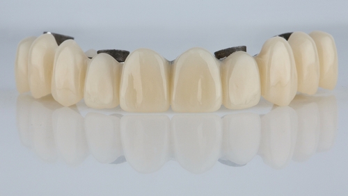 dental implant recovery immediate load