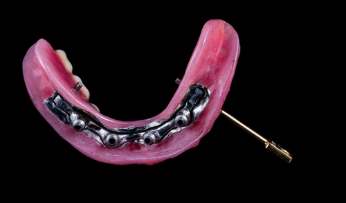 dental implant recovery all-on-4