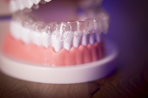 Dentistry Dentures With Invisalign Orthodontics