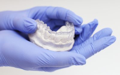 From Start to Finish: A Patient’s Journey with Invisalign Treatment