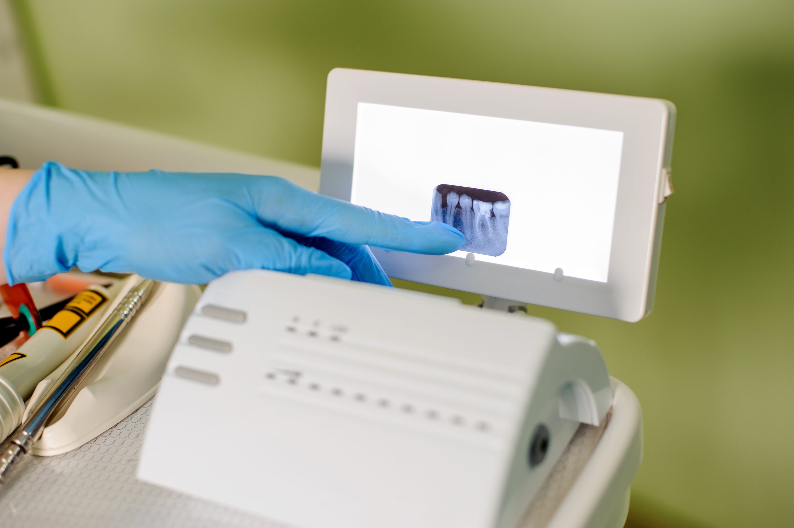 Dentist,Showing,X-ray,In,Stomatology,Office,,Focus,On,X-ray.,Teeth dentist showing an xray