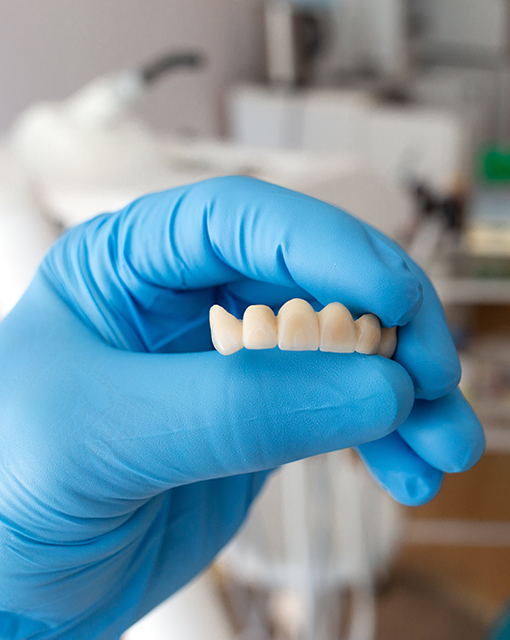 The,Dentist,Holds,A,Ceramic,,Zirconium,,Bridge-shaped,,Non-removable,Dental,Prosthesis male patient receiving emergency dental care from sekhon family dentistry on carling avenue