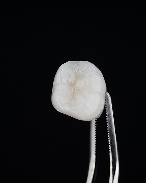 Porcelain,Veneers,Crown,Ceramic,Teeth,Tooth,Dental,Dentist,Beautiful male patient receiving emergency dental care from sekhon family dentistry on carling avenue