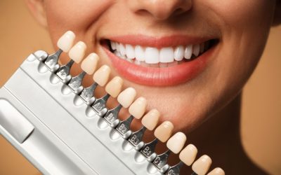 The Benefits of Professional Teeth Whitening vs. Over-the-Counter Products