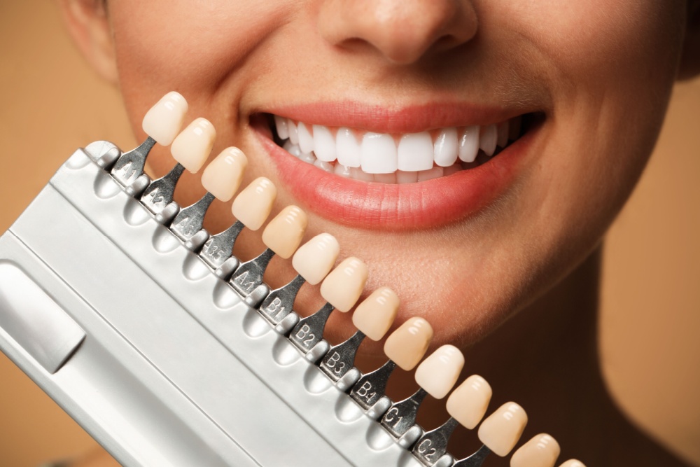 woman with teeth color samples 